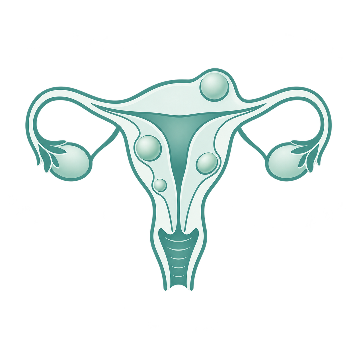 miomas